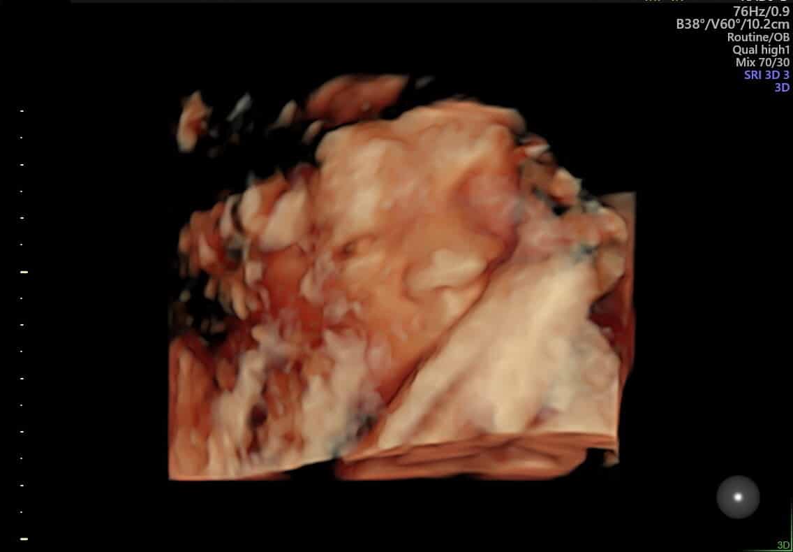 inscription f18d2f964f2bf66e0f8a0930e7f53313d5b95e59717f53580fc8adcd091e4abdi0